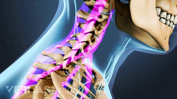 cervical facet joint with cartilage and synovial-fluid