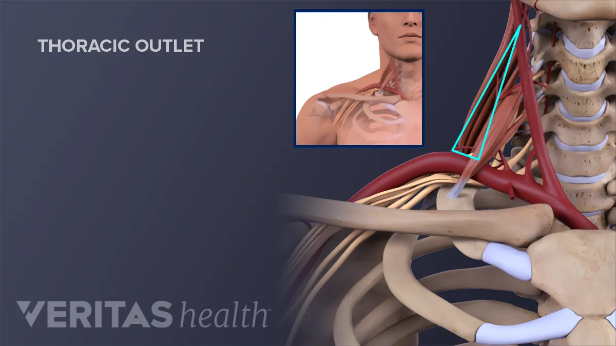 https://embed.widencdn.net/img/veritas/17ubs6xa0e/1200x675px/nerves-in-neck.thoracic-outlet.webp