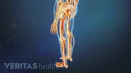 Figuring Out Sciatica Treatments