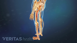 Medical illustration of the lower body, the sciatic nerve is highlighted in red to indicate pain, numbness or tingling.