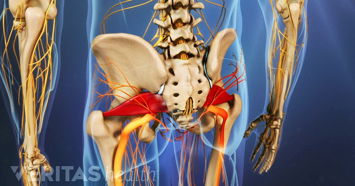 piriformis syndrome nerve sciatic sciatica musculoskeletal treatment buttock cause symptoms spasm veritas spasms