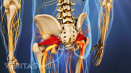 Posterior view of piriformis muscles in the buttocks.