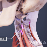 Profile of the neck and skull highlighting the tendons in the cervical muscles.