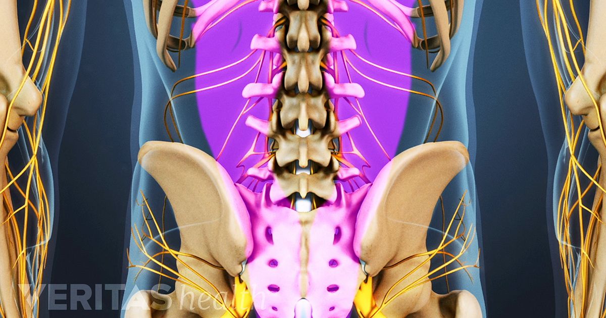 Tlif Back Surgery Indications And Technique