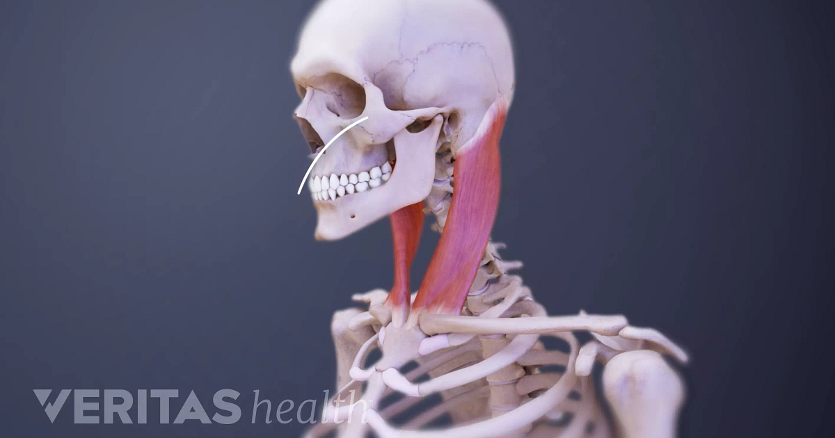 Neck Spasms Animation