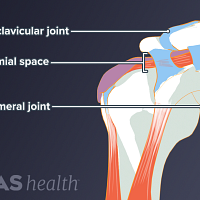 Illustration of shoulder anatomy including the AC joint, glenohumeral joint, and subacromial space