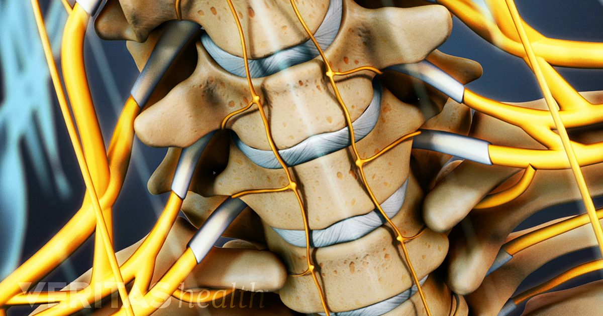 What Is Degenerative Disc Disease?