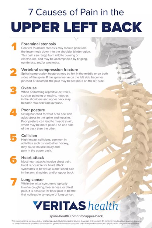 mid to high back pain