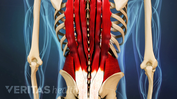 Immediate Treatment for a Back Muscle Strain diagram of nerves flank 