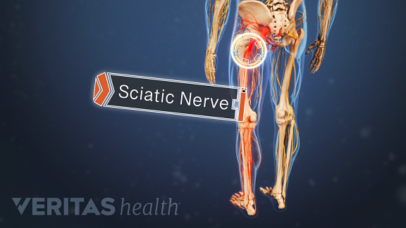 Posterior view of the lower body labeling the sciatic nerve