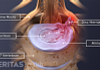 How Massage Can Ease Sciatic Pain