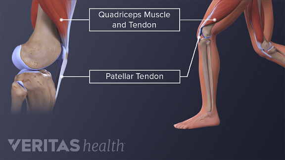 Medicine For Tendonitis In Knee - MedicineWalls