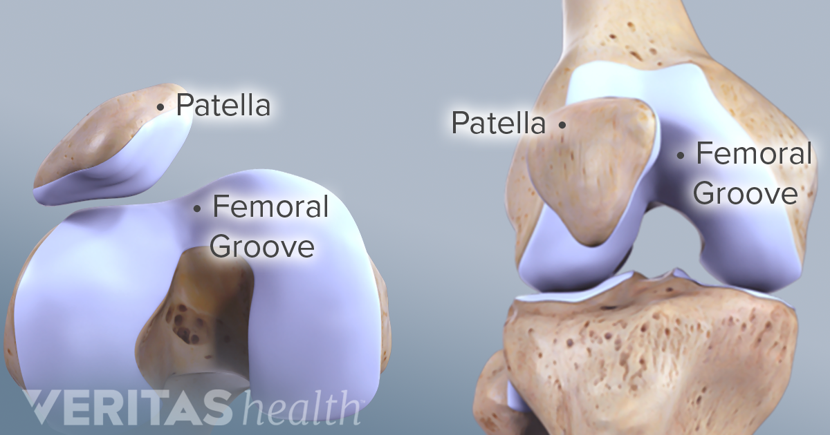 what causes knee cap to move