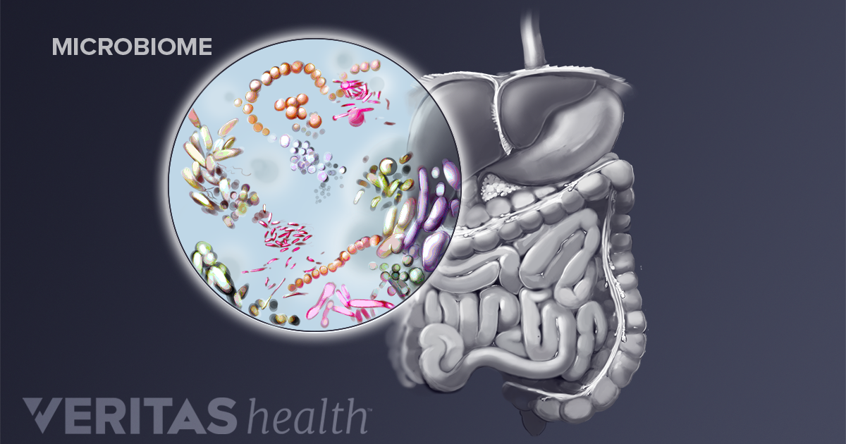 Improving the Gut Microbiome and Arthritis Symptoms with Diet 