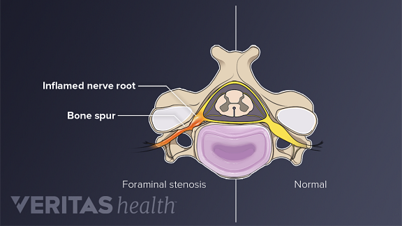 All About The C7 T1 Spinal Segment Cervicothoracic Junction