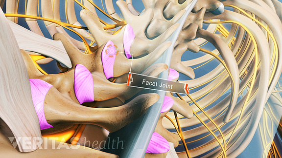 Illustrated skeleton highlighting facet joints in the spine