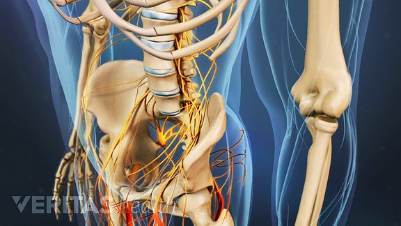 Cauda Equina Syndrome