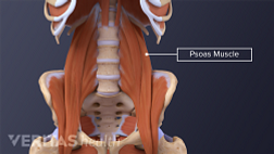 PSOAS肌肉中的紧张会导致腰痛。