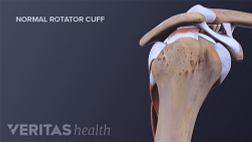 Anterior view of the shoulder joint with a rotator cuff