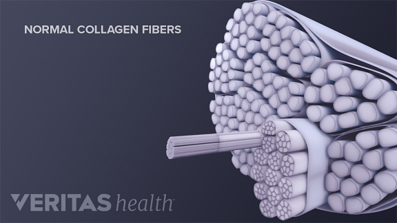 Normal collagen fibers that make up a tendon