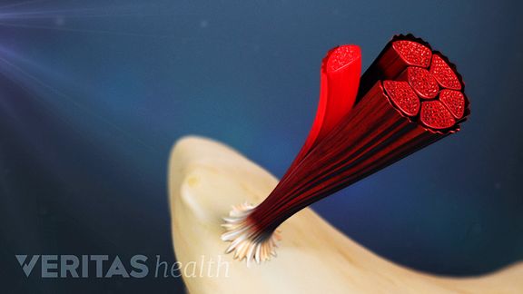 Causes and Diagnosis of Lower Back Strain