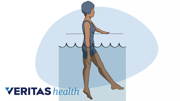 Ankylosing Spondylitis