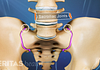 Anterior view of the pelvis highlighting the sacroiliac joints on both sides.