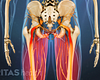 Posterior view degenerative spondylolilsthesis in the legs.