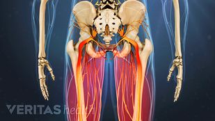 退行性Spondylolilsthesis