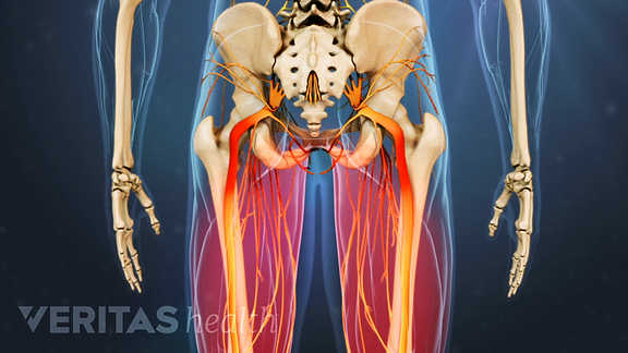 Degenerative Spondylolisthesis Video
