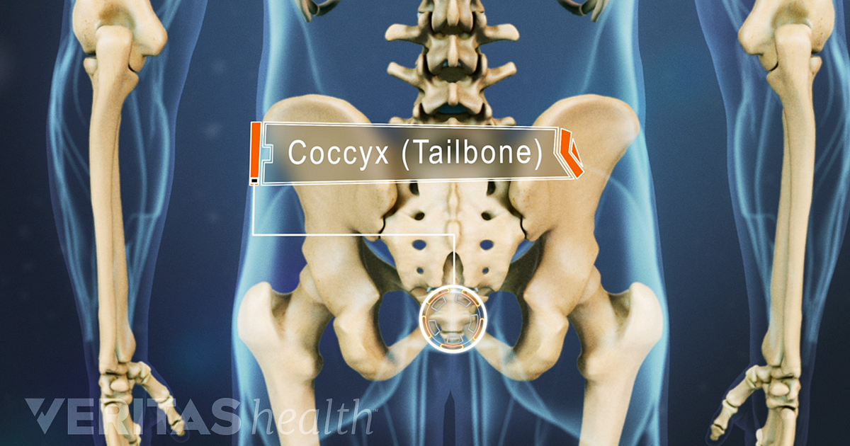coccyx bone sticking out