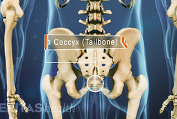 Coccydynia (Tail Bone Pain) Video