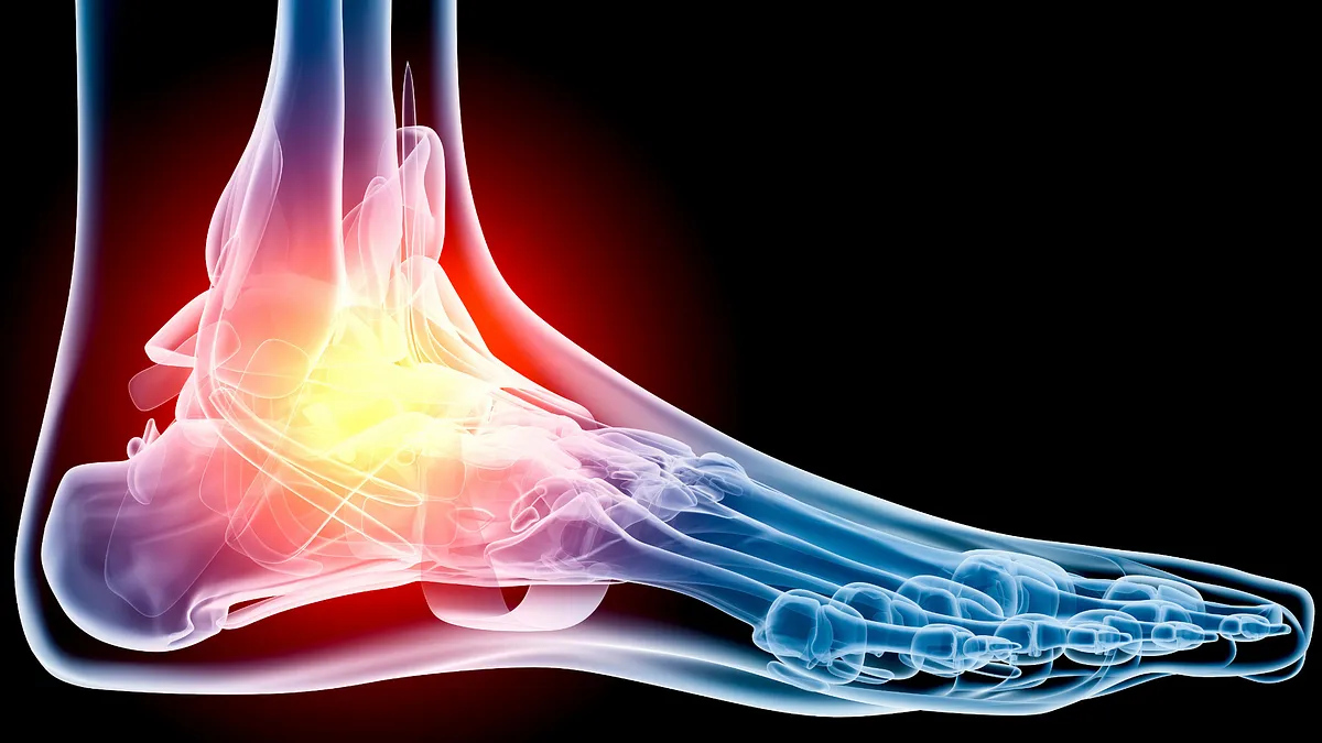Can Sciatica Cause Foot Pain?