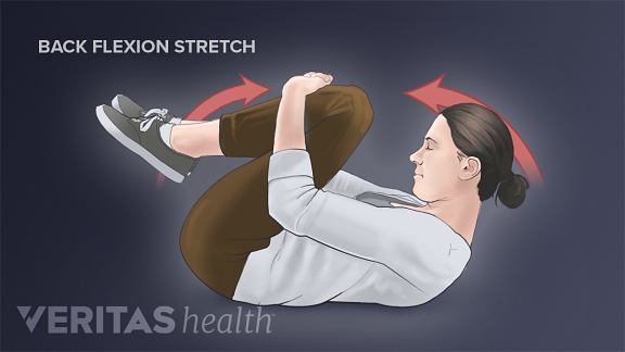 Exercise For Sciatica From Spinal Stenosis 