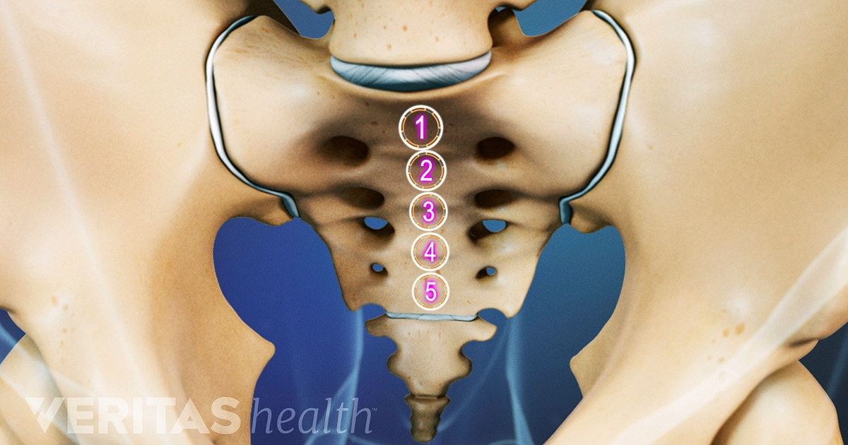 what-to-know-about-sacroiliac-joint-fusion