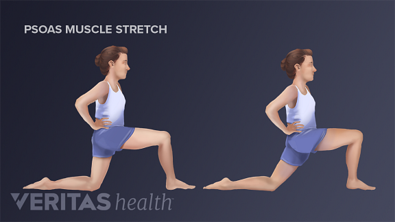 Ilustración del estiramiento del músculo psoas