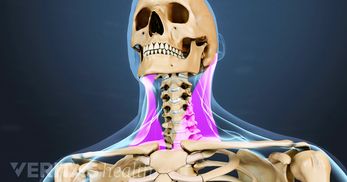 Neck Strain Causes And Remedies major-muscles-of-the-neck-iron-neck-uk-europe