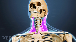 a nyaki régió osteochondrosisa c5 c6