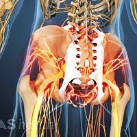 Posterior view of a lower back with pain in the SI joint.