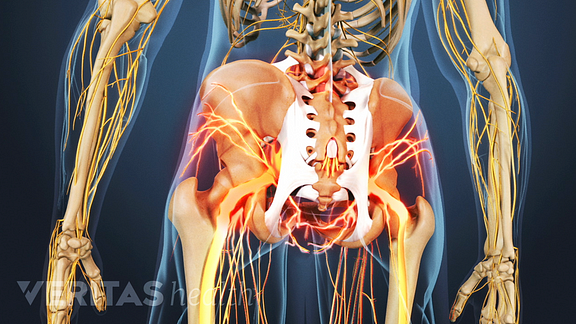 Medical illustration of the lower back and sacroiliac joint