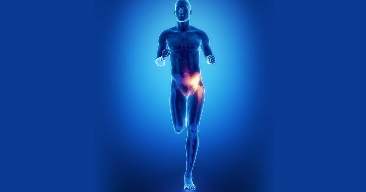 Common Running Injuries: Hip or Thigh Pain Common Running Injuries: Hip or Thigh Pain