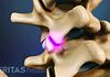 facet joint pain treatment options