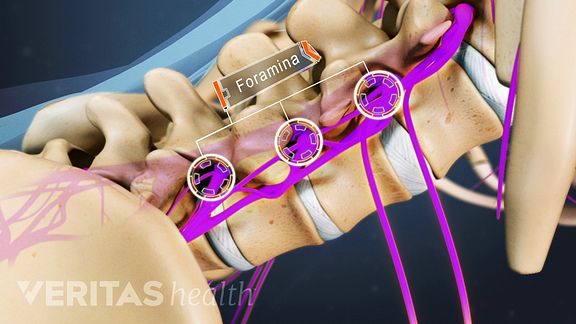 Lumbar Spine