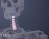 Transparent cervical spine with the discs highlighted.