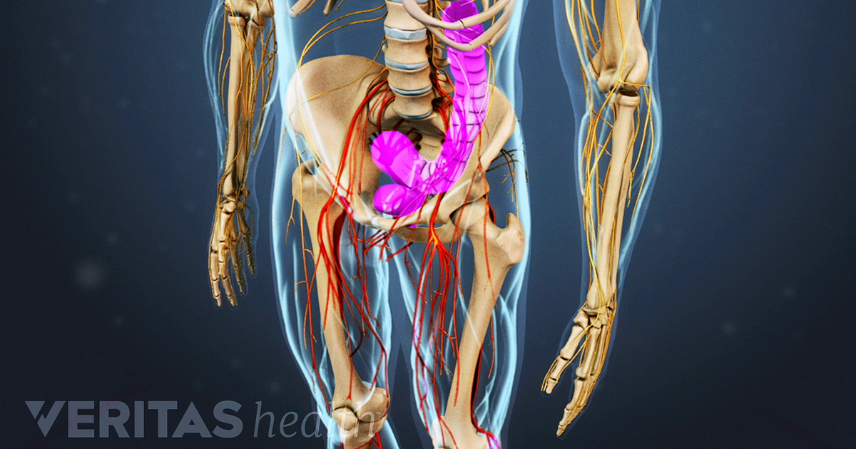 anterior cervical decompression and fusion for cervical cervical spondylosis with myelopathy