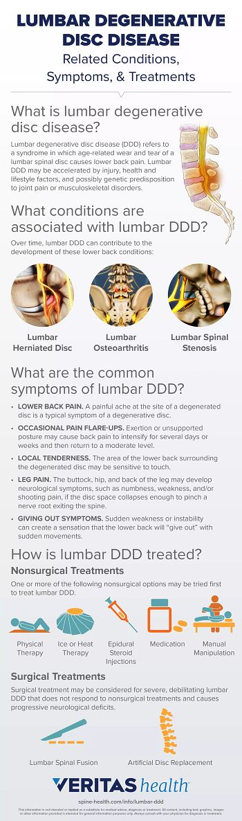 Lumbar Degenerative Disc Disease