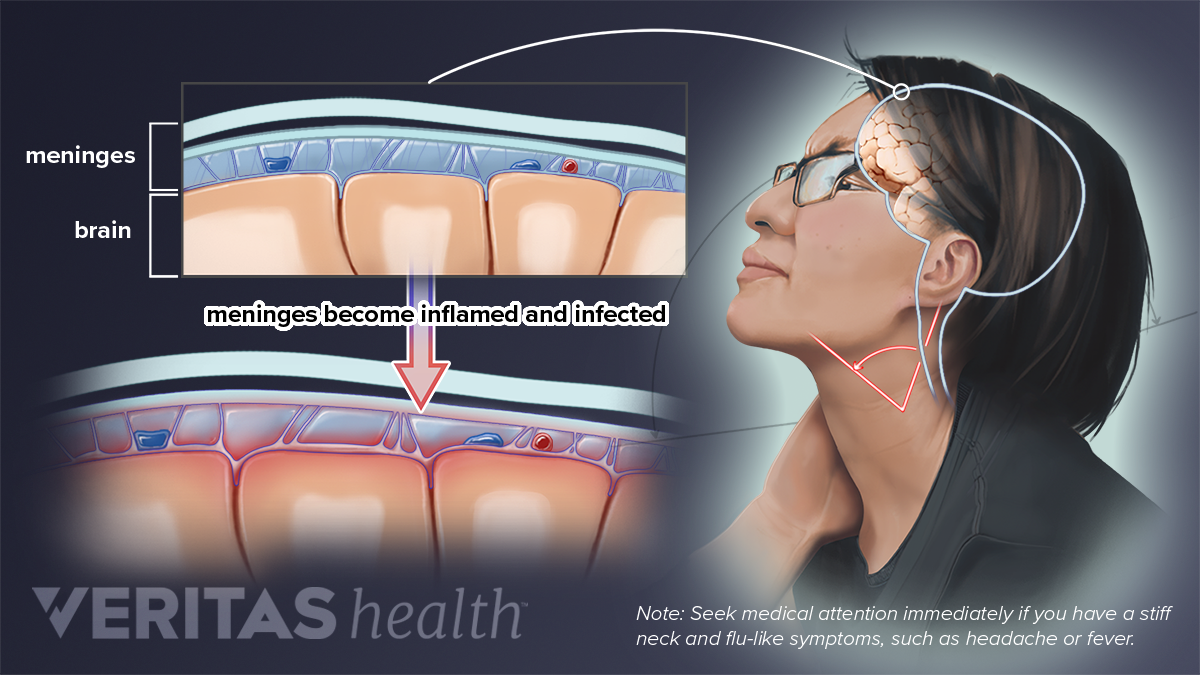 2 Neck Pain Symptoms That Require Immediate Medical Attention