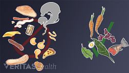 Illustration of anti-inflammatory foods and foods that may cause inflammation