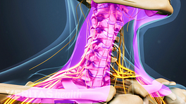 Osteochondrosis a nyaki gerinc és a lemez kiemelkedés, a kezelés a nyaki gerinc