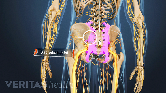 An illustrated view of the lower back and legs. The sacroiliac joint is labeled